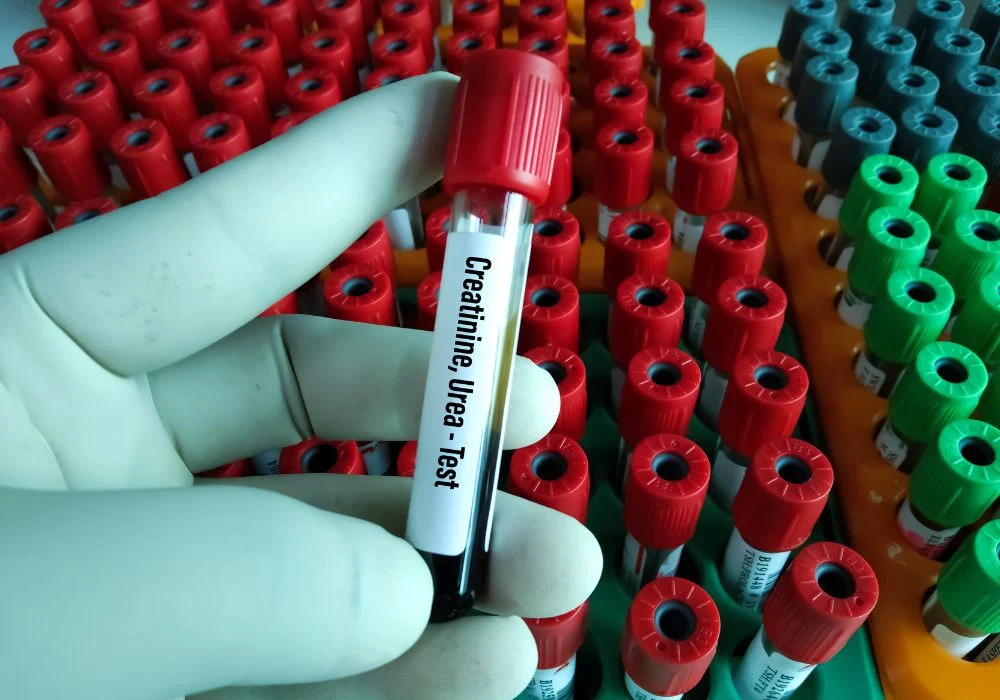 creatinine meaning
